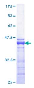 SDS-PAGE (CREBBP-1852H).jpg